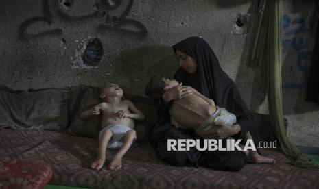 Potret Pilu Anak-Anak Gaza yang Menderita Kelaparan Akut